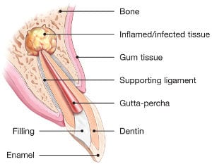 Surgical Endodontics