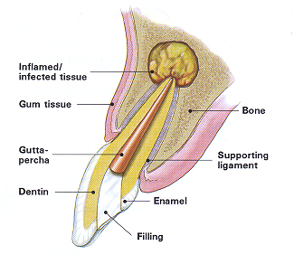 Surgical Endodontics