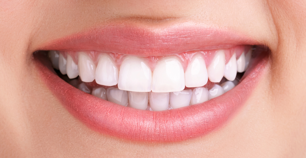 teeth whitening services in Andheri West