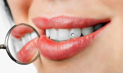 Tooth Jewellery in Andheri West